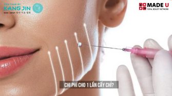 Chi phí cho 1 lần cấy chỉ bao nhiêu tiền? Giải pháp trẻ hoá da mới nhất 2025